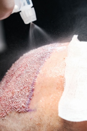 Adhemar Jr. | Transformando vidas além da beleza